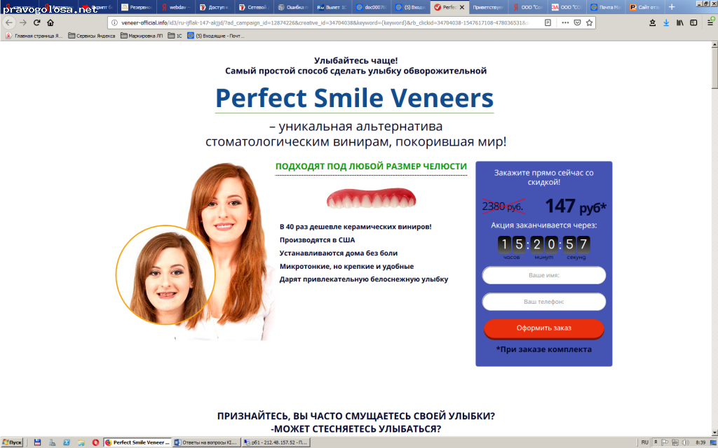 Отзыв на Perfect Smile Veneer